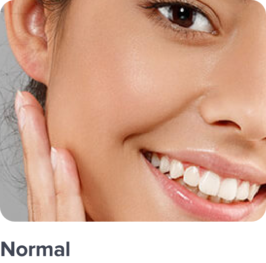 /skincare-cce-brands/?f[target_skin_type]=normal&sort[by]=popularity&sort[dir]=desc&limit=50