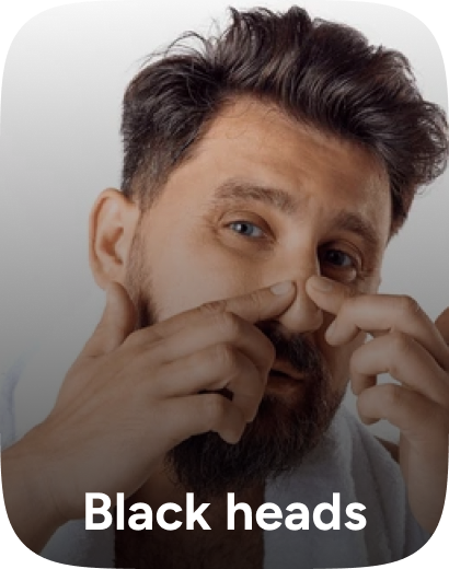 /beauty/skin-care-16813/tools-and-accessories/blackhead-acne-remover/