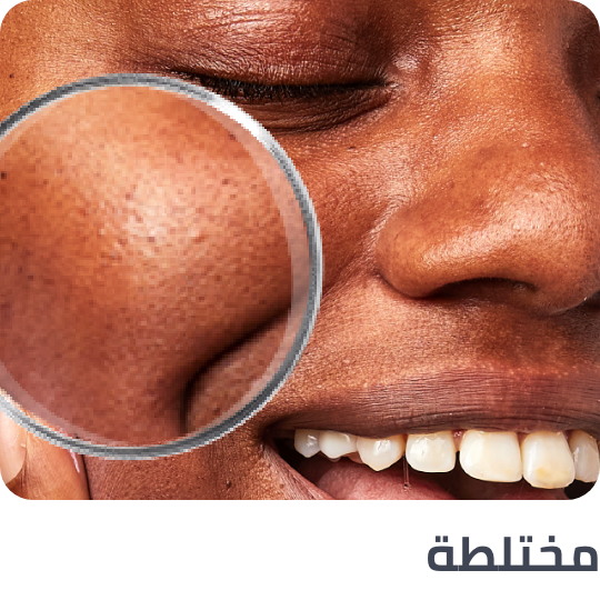 /skincare-cce-brands/?f[target_skin_type]=combination&sort[by]=popularity&sort[dir]=desc&limit=50