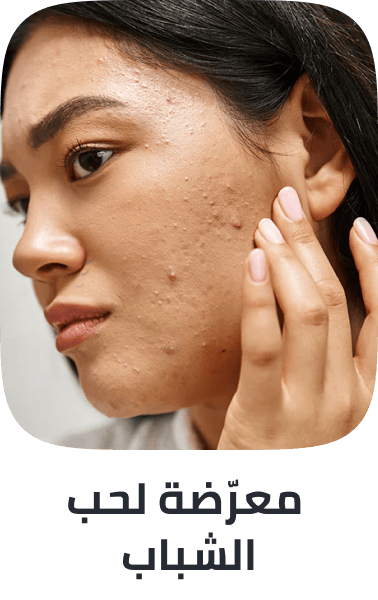 /beauty/skin-care-16813/sun/?f%5Btarget_skin_type%5D%5B%5D=acne