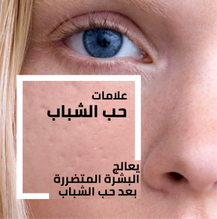 /atopic-skin?sort[by]=popularity&sort[dir]=desc