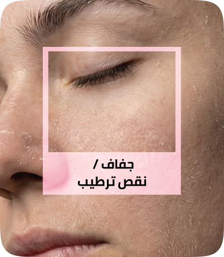 /eg-apr26-skinify-5/