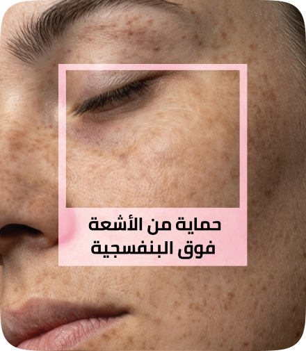 /eg-apr26-skinify-3/