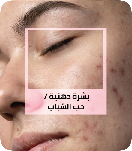 /eg-apr26-skinify-2/