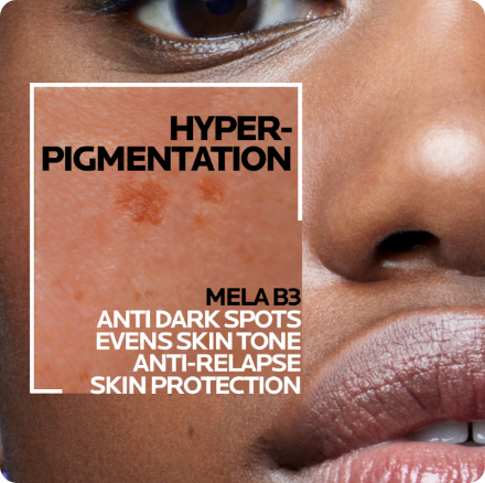 /eg-mela-b3/?sort[by]=popularity&sort[dir]=desc&limit=50