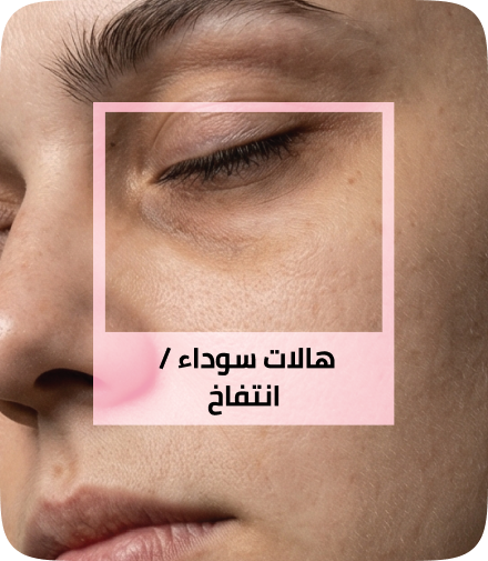 /eg-apr26-skinify-6/