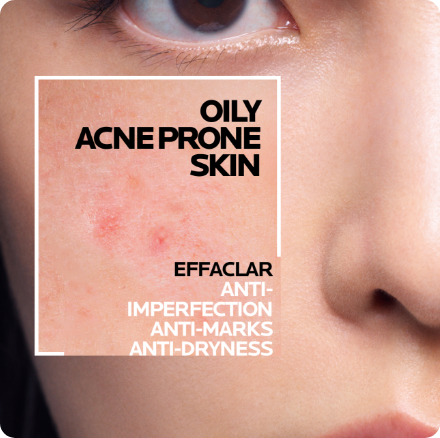 /eg-lrp-effaclar-h/?sort[by]=popularity&sort[dir]=desc&limit=50