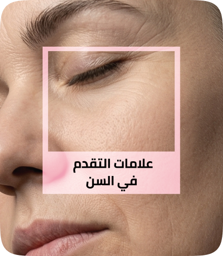 /eg-apr26-skinify-1/