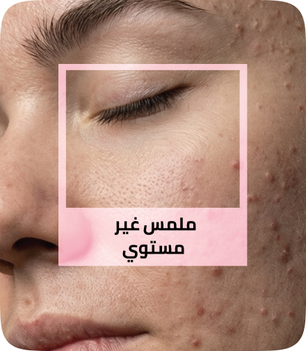 /eg-apr26-skinify-4/