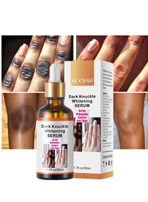 Dark Knuckle Whitening Serum 7 days Treatment for Dark Spots in Hand and Feet Knuckles Exfoliating Improves Dullness Powerful Whitening Effect for Men and Women 50ml 